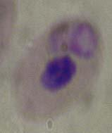 dimpled nucleus, larger than a lymphocyte,