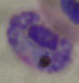 visible than in lymphocytes.