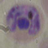 granules in cytoplasm, granules are a purple