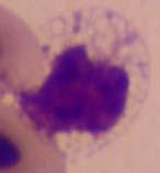 Thrombocyte- platelets, round dark nucleus