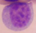 smaller than a lymphocyte, easily confused