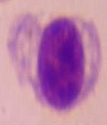 Plasmodium- cause of avian malaria,