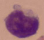 granules in cytoplasm, hot pink segmented