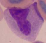 Basophil- granulocyte, circular granules in
