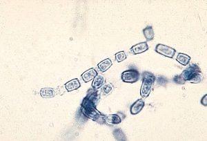 Anthroconidia of Coccidioides immitis. The life cycle of Coccidioides spp. is unique.