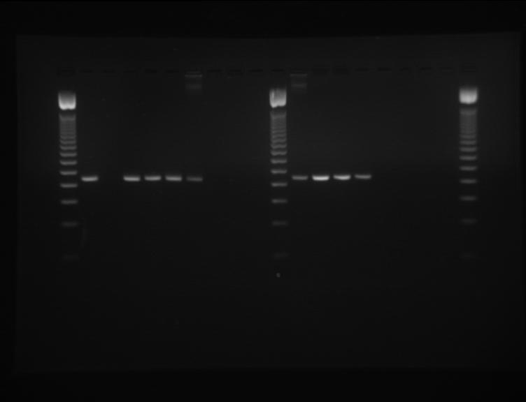 L 1 2 3 4 5 6 7 8 9 L 1 / 2 / 3 / 4 / 5 / 6 / 7 / 8 / 9 / L 250bp 200bp 150bp 100bp 50 Fig. 1: Agarose Gel Electrophoresis of PCR for meca Gene Presence.