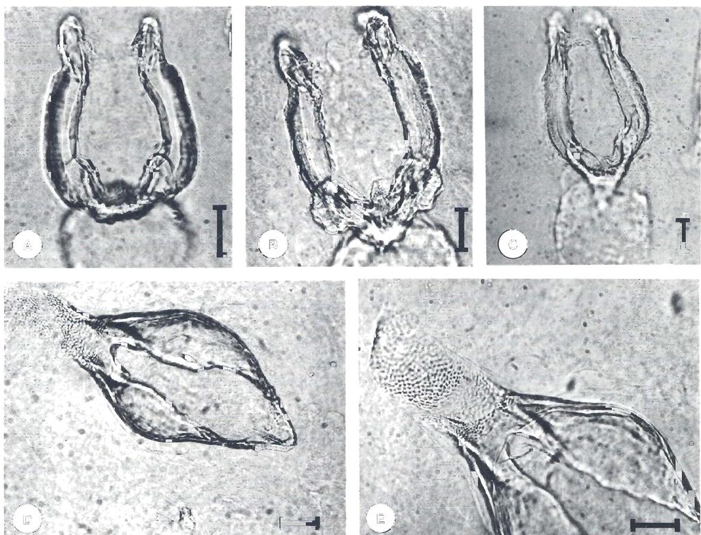 K. JUNKER & J. BOOMKER 'l';. "0,. FIG. 1 Pelonia africana n. g., n. sp. A Oral cadre of holotype male.