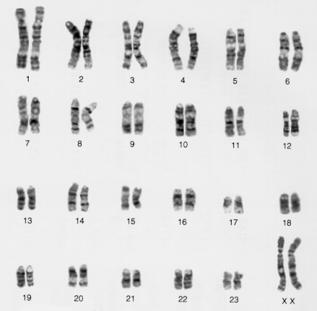 A female has XX homologous chromosomes for sex determination.