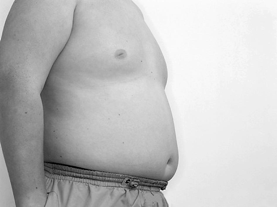 3. People with a body mass index (BMI) of over 30 are said to be obese.