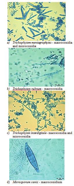 clavate macroconidia and abundant pyriform microconidia (Figure 4c). Characteristic of Microsporum canis culture are: fast growth, flat colonies, white-yellowish surface; golden yellow colony reverse.