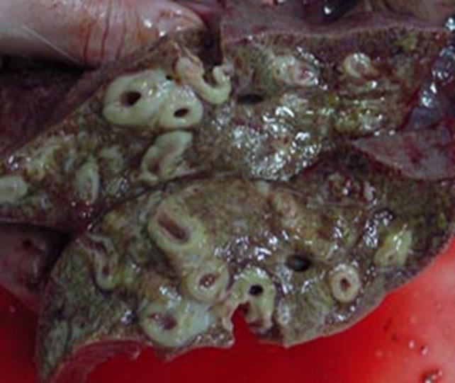 initial infection Mature fluke in liver and