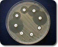 To perform antimicrobial susceptibility tests applied to the microorganism previously