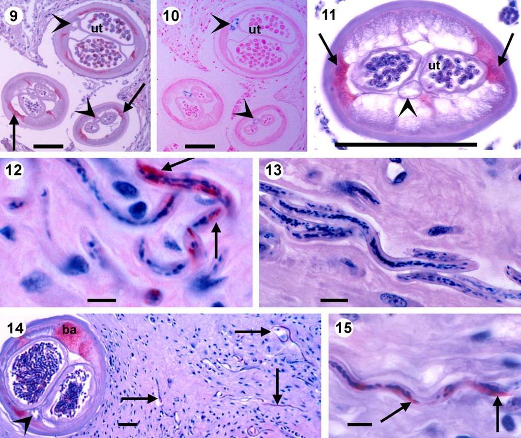 Parasitol Res (2009) 106:23 31 29 Fig. 2 A newly acquired young female worm full of endobacteriapositive morulae in the uterus (ut) and with sparsely iron in the gut (arrowheads).