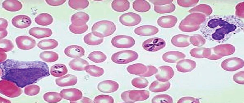 erythrocytes, where they asexually reproduce by budding. As the parasites multiply within the blood, the disease begins to clinically manifest itself.