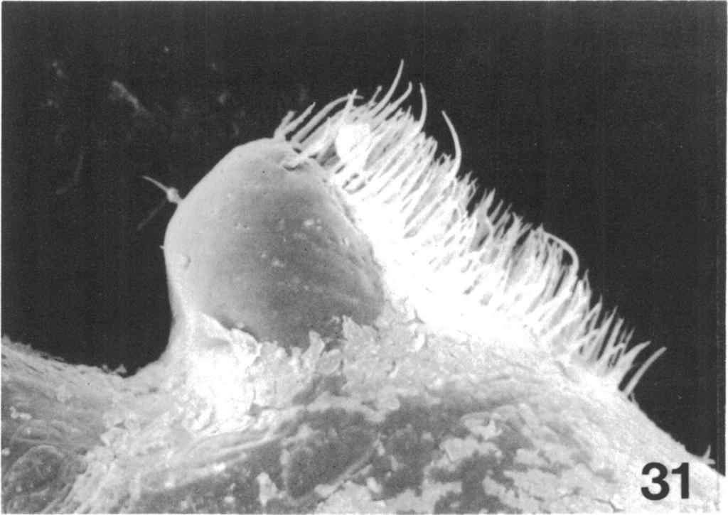 1986 SHEAR: ISCHYROPSALIDOIDEA 21 I -)l.., "z I w,,- - o.11i 31' FIG. 31. Scanning electron micrograph of cheliceral gland mound ofmale Acuclavella merickeli; lateral view, x 120.