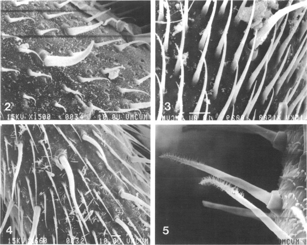 1986 SHEAR: ISCHYROPSALIDOIDEA 7 0I 1X I;x a U'\ FIGS. 2-5. Scanning electron micrographs of parts of palpal tibiae. All bars = 10 gim. 2. Acuclavella merickeli (distal to lower right, x 975). 3.