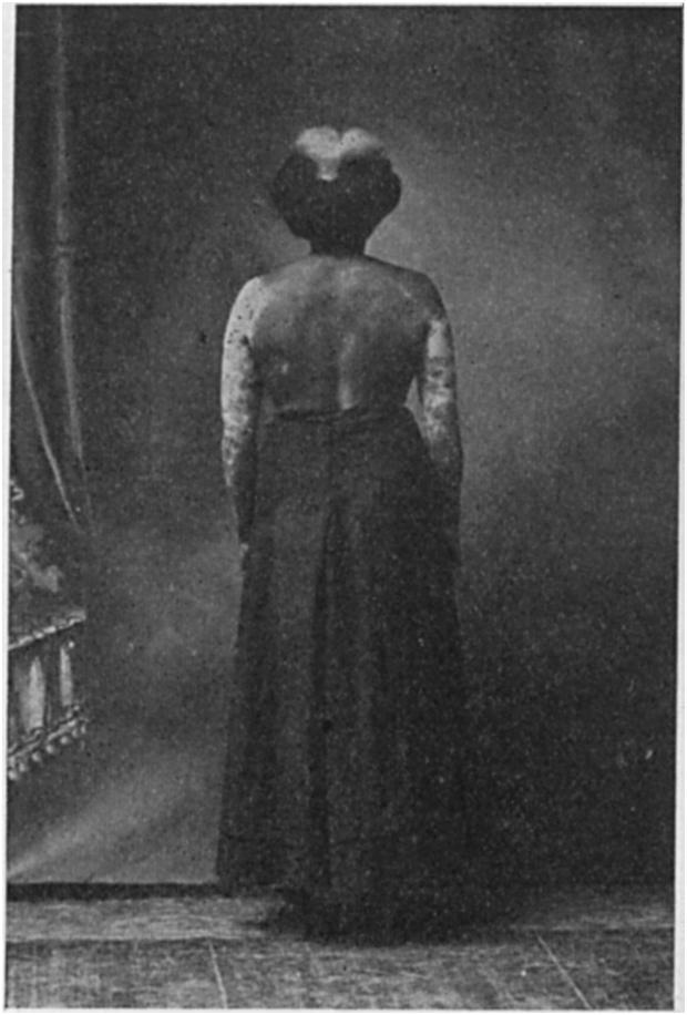 52 THE AMERICAN NATURALIST [VOL. XLVI1 Fig. 1, the back-stripe is so wide that it covers the sides of the body also. The original mutant, founder of this line of spotted negroes, Mrs. S. A., is still living.