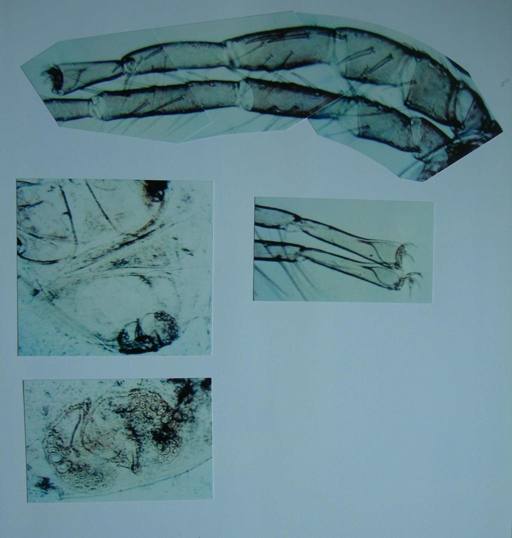 Plate 186: Unionicola formosa from Pyganodon cataracta in North Carolina: Top: male leg I.