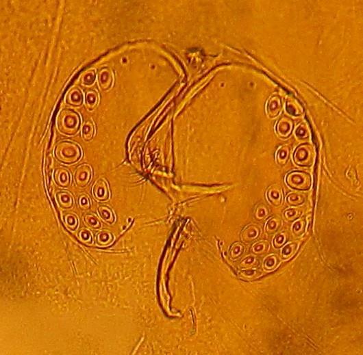 Plate 4: female genital field from U.