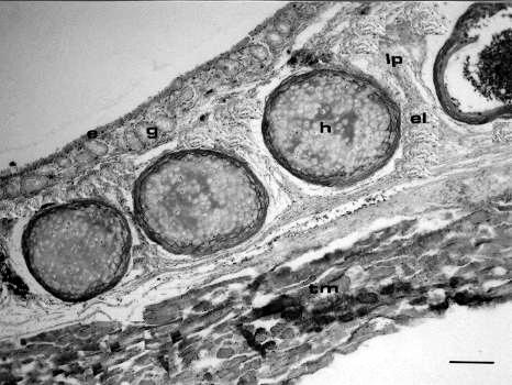 (bs1), membrana tympaniformis lateralis (l), membrana tympaniformis medialis (m), m. sternotrachealis (st), m. tracheolateralis (tl). Fig. 3.