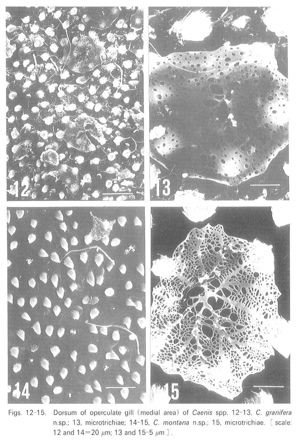 Figs. 12-15. Dorsum of operculate gill (med ial area) of Caenis spp. granifera n.sp.; 13, microtrichiae; 14-15, C.
