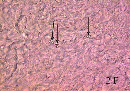 Depositing of spermatozoids in the genital tracts of female Lacerta agilis and Zootoca vivipara: 2A few spermatozoids in the lower parts of the oviduct of female L.