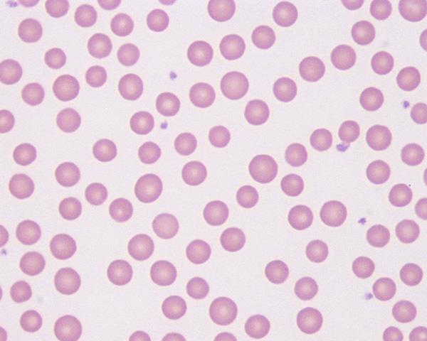 red blood cells Anaplasma infected red