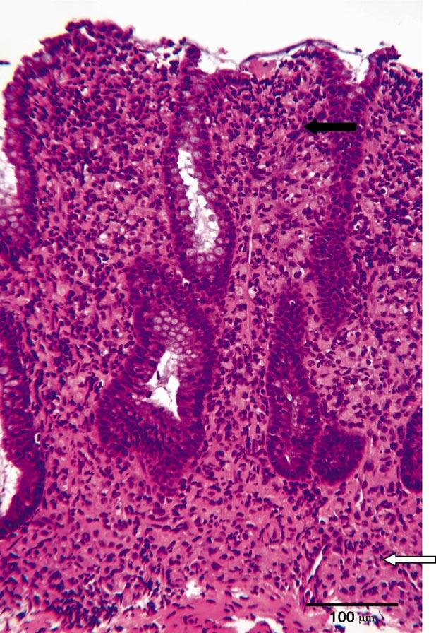 500 Hostutler et al Fig 1. Hematoxylin-eosin stain of a colonic biopsy from a dog with histiocytic ulcerative colitis (HUC).