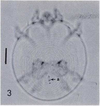 SHORT COMMUNICA11ONS 253 V,: r p + + S I 3.4 FIGURE 3. Female Notoedres cati isolated from Florida panther number 208, focusing on the anus (a) and dorsal scales. Bar = 50 ion. FIGURE 4.