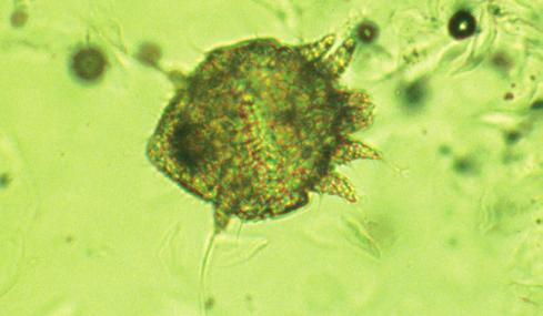 These mites have a markedly characteristic body shape with the lateral margins extending between the limbs (Figures 11 and 12). The eggs are cemented to the base of hairs.
