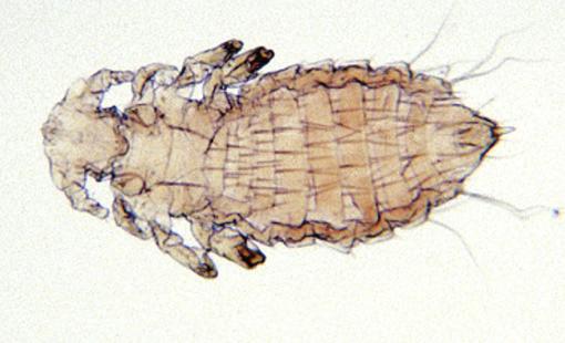 Skin scrapings are recommended to demonstrate the presence of these mites.