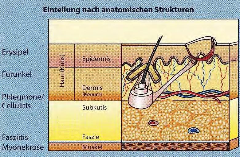 Anatomy of Skin and Skin structure infections From: P.