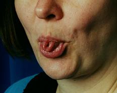 The aility to curl your tongue is also genetic.