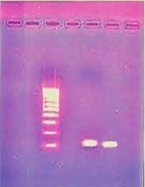 El Dahshan and Nada (2015) M 1 2 3 154 bp Photograph (2): Agarose gel electrophoresis of PCR amplified products using meca primers for detection of Methicillin-Resistant S. aureus "MRSA".
