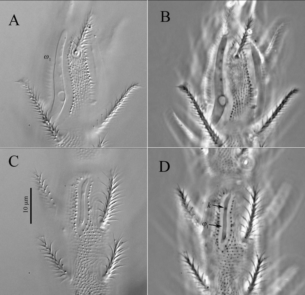 A new genus of Eupodidae Fig. 8. DIC (A, C) and phase-contrast (B, D) micrographs of Echinoeupodes echinus sp. n., female: A, B tarsus I in dorsal view, B, D tibia I in dorsal view.
