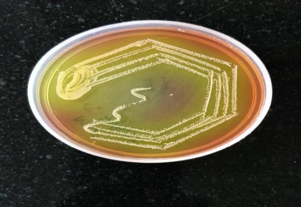 Fig.1 Yellow colonies of Staphylococcus aureus