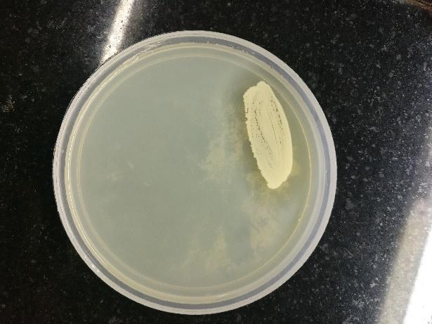 2 Zones around the bacterial colonies indicates