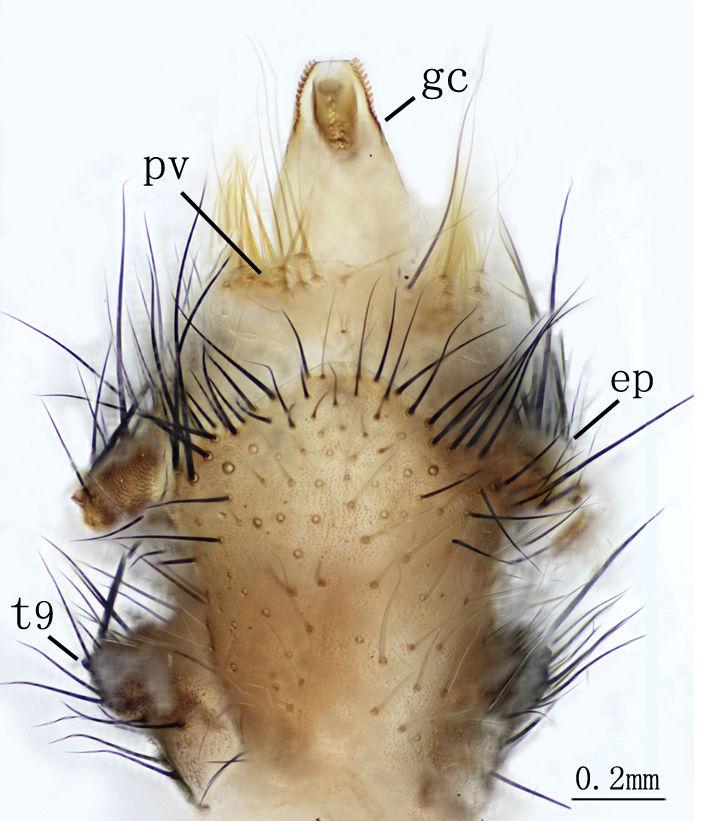 Two newly recorded genera and species of Owlflies (Neuroptera: Ascalaphidae)... 7 Figure 7. Nousera gibba Navás, 1923, Abdomen terminal of male with gonarcus-paramere complex, ventral view.