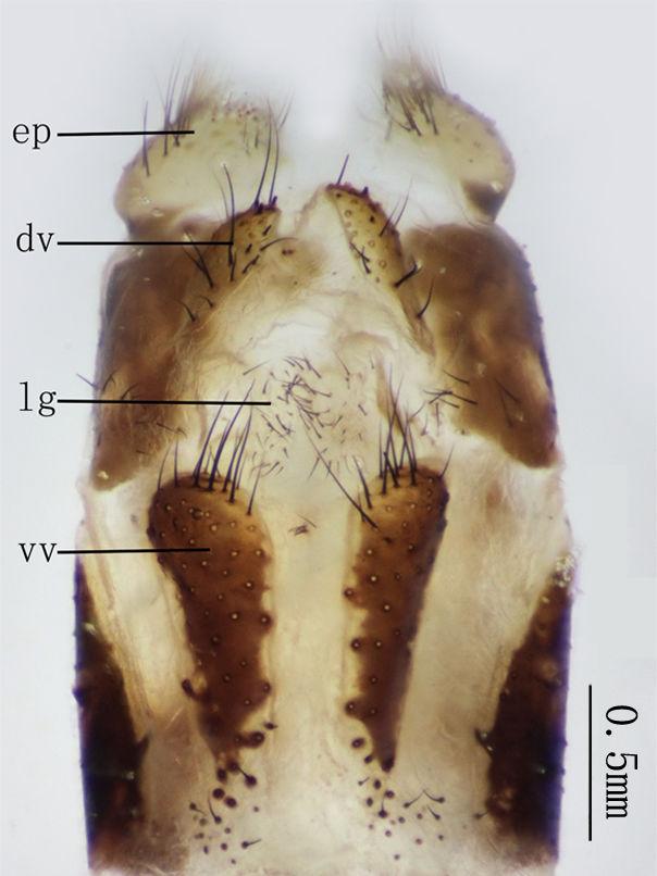 The 1 tergite lower slightly, the 2 tergite not elevated Fig. 5. Female genitalia Figs 8, 9. Ectoprocts sub-elliptical in lateral view, yellow with brown setae.