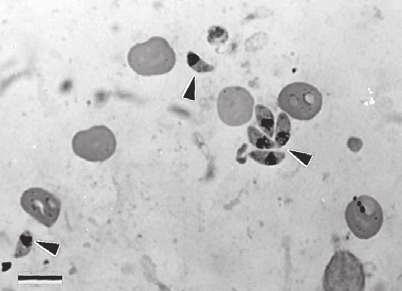7 E. Petersen and J. P. Dubey Figure 1.4 Toxoplasma gondii tachyzoites (arrowheads) in smear. Mouse peritoneum. Giemsa stain. 750. Bar 10 m.