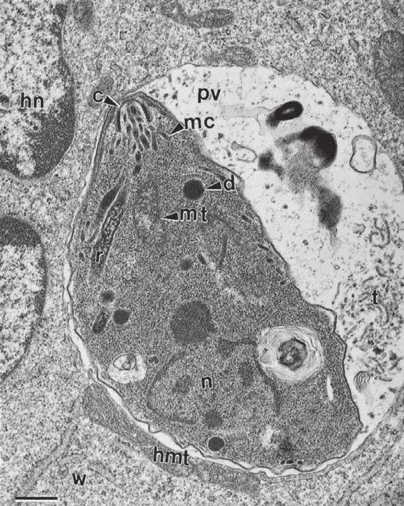 8 Biology of toxoplasmosis Figure 1.5 ectron micrograph of a T.