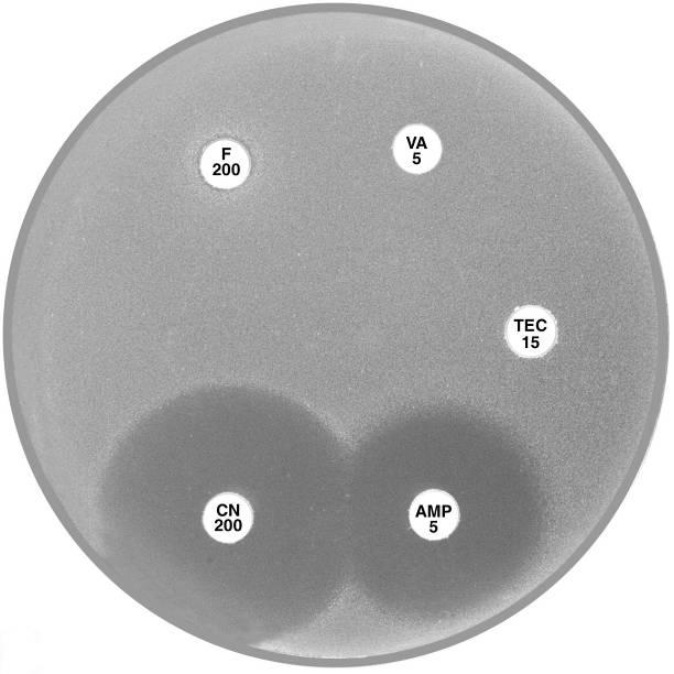 and teicoplanin (TEC 15) is typical of the vana phenotype. Plate 12.