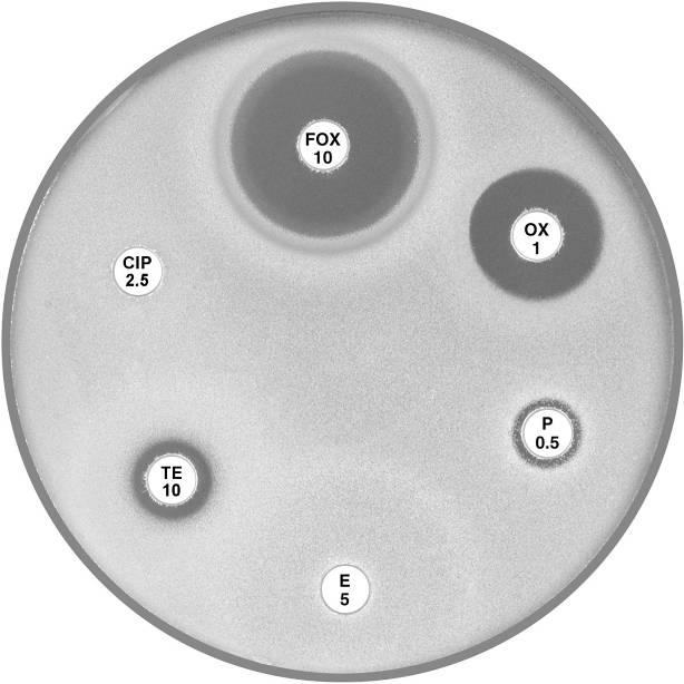 B Staphylococcus aureus with low β-lactamase activity The reduced inhibitory zone 5) with an annular radius of 4