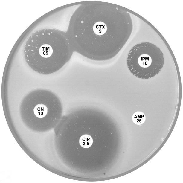 B Acinetobacter baumannii Note the large inhibitory zone around amoxycillinclavulanic acid (AMC 60), a small one around