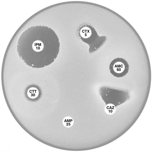 12. Enterobacter and Citrobacter Plate 12.12.A Enterobacter cloacae with AmpC β-lactamase The flattened
