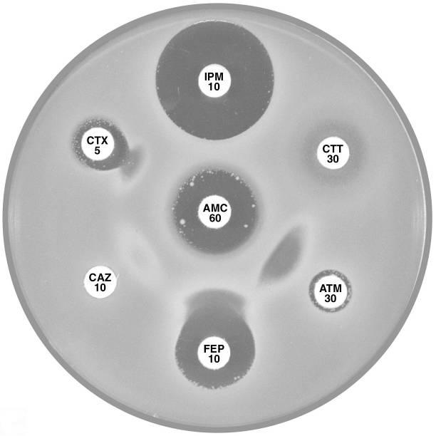 presence of a basal inducible cephalosporinase. Plate 12.