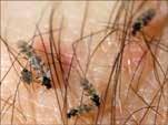 Midges (No See Ums) Our tiniest biting flies Tend to be sporadically encountered Pack a
