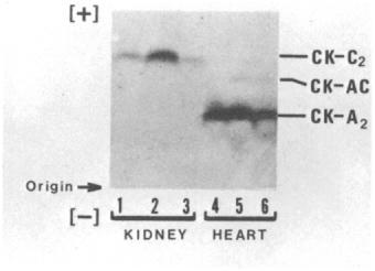Both the Ck-A and Ck-C loci are monomorphic with interlocus heterodimers formed in heart tissue extracts.