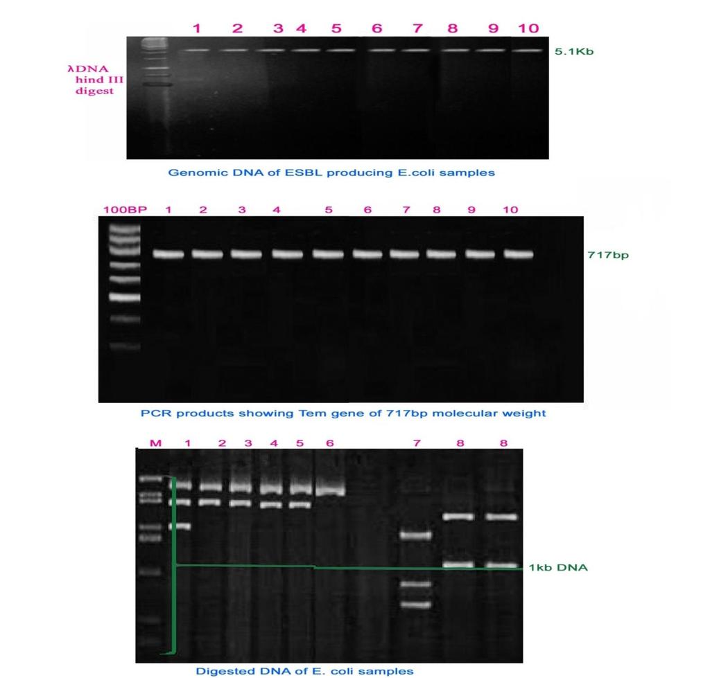 4.4 Plasmid Analysis-Molecular