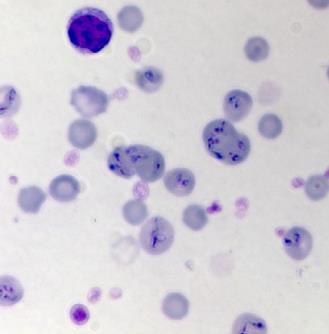 8) Babesia sp. Babesia sp. from the blood of a cow.